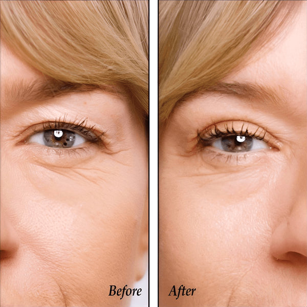 Invisible Eyelid Lifters Tape - Lift & Brighten Eyes